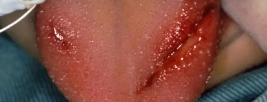 症状の写真（８）